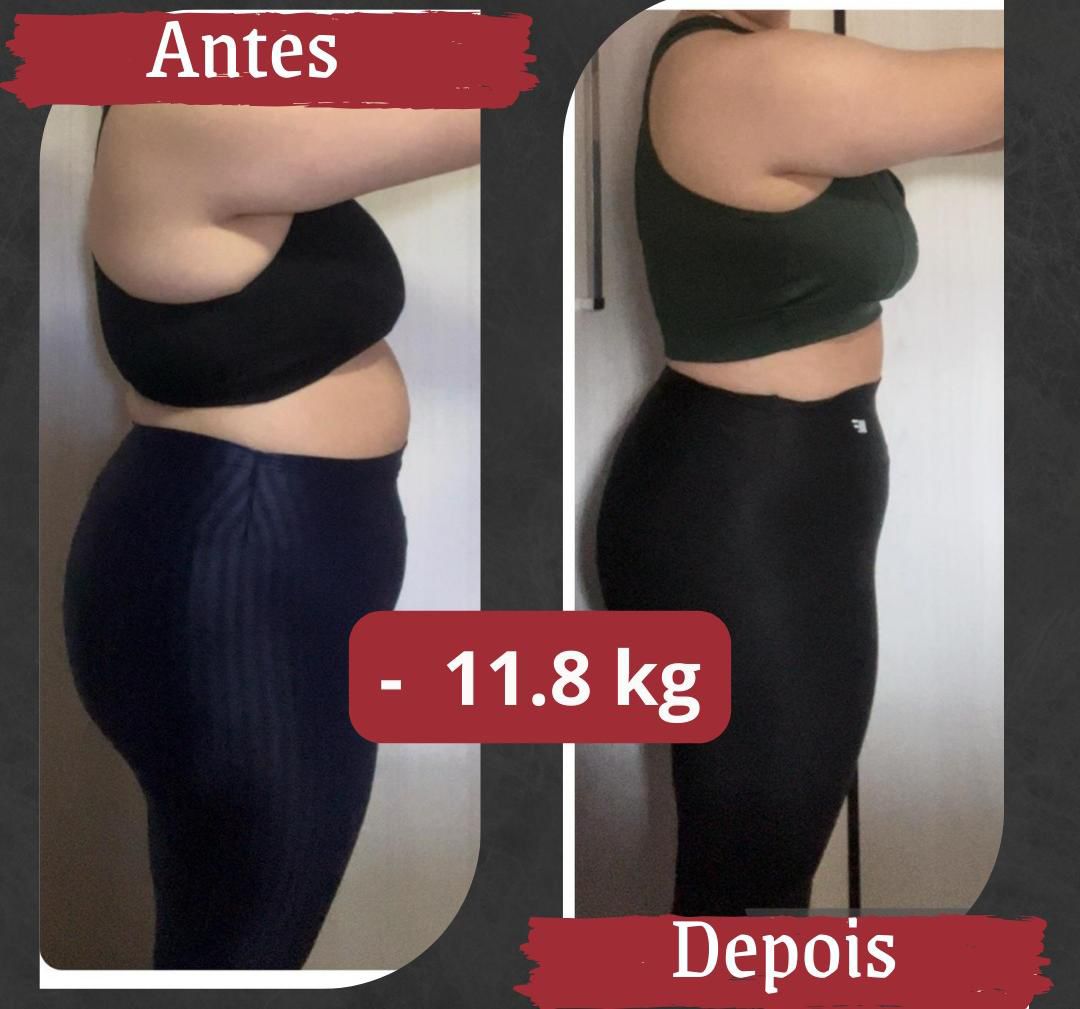 Antes e depois 5