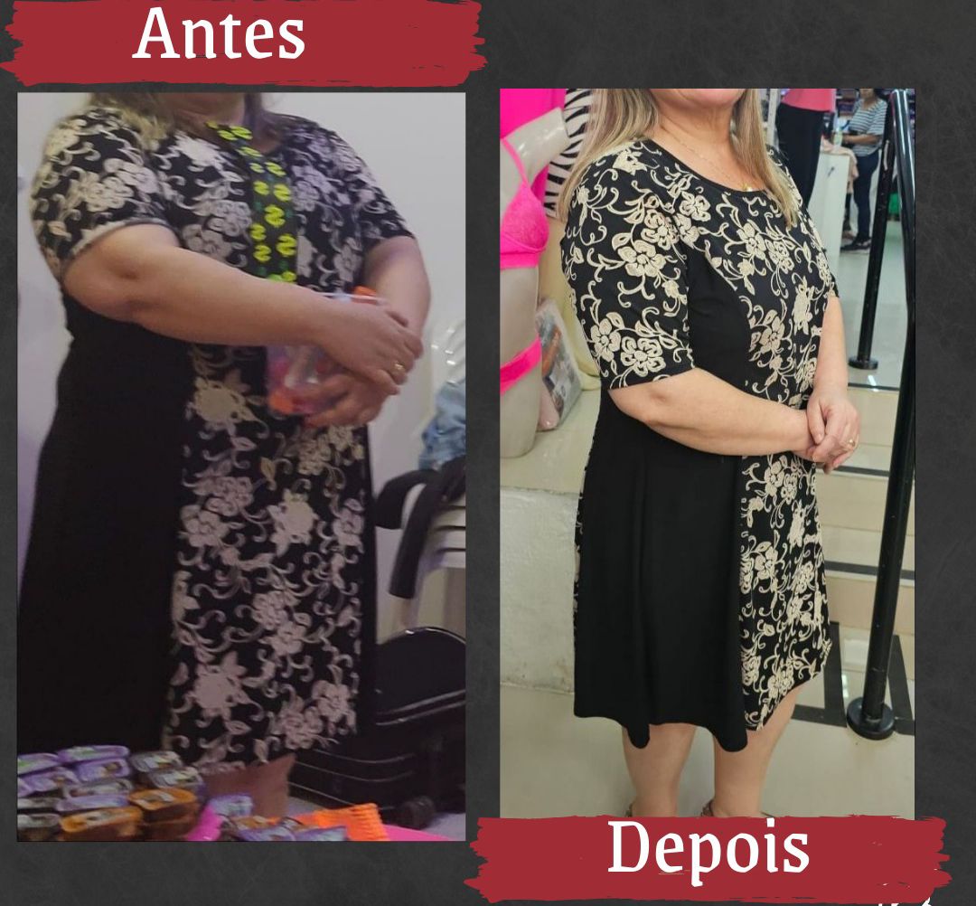 Antes e depois 6